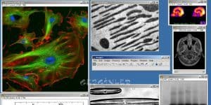 ImageJ 2.1.4.7 p1 logo